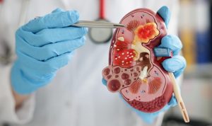 5 Minuman Sehat untuk Meningkatkan Fungsi Ginjal, Nomor 4 dan 5 Sering Dikonsumsi