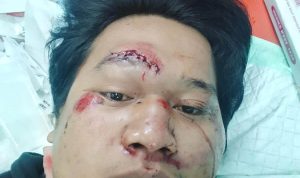 Diduga Penabrak Kabur Usai Kecelakaan di Lampu Merah Srengseng, Korban Dilarikan ke RSUD Kembangan