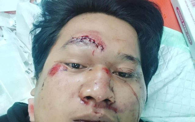 Diduga Penabrak Kabur Usai Kecelakaan di Lampu Merah Srengseng, Korban Dilarikan ke RSUD Kembangan