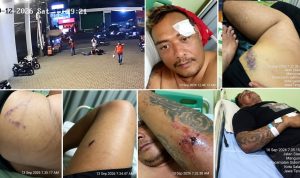 Korban Dugaan Pengeroyokan Menggunakan Linggis di Salatiga Dirawat di RSUD, Istri Lapor Polisi, FERADI WPI Kawal Kasus hingga Tuntas